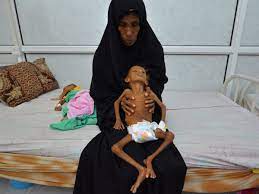 Famine in Yemen could become one of worst in living memory, UN says | Yemen  | The Guardian