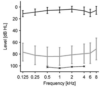 330px-LDL-Audiogram.jpg