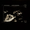 cause4concern.bandcamp.com