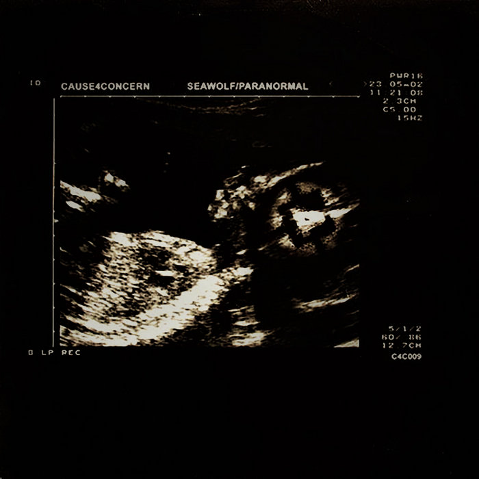 cause4concern.bandcamp.com
